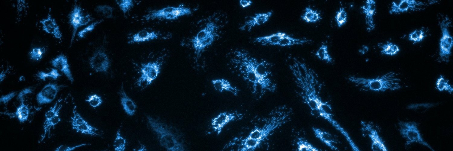 Fluorescence micrograph of mitochondria in pulmonary artery endothelial cells.