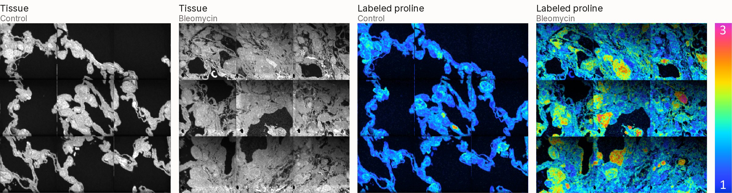 Multi-isotope imaging mass spectrometry of control and bleomycin-injured mouse lung: tissue images alongside maps of labeled proline incorporation, which is markedly higher in fibrotic regions.
